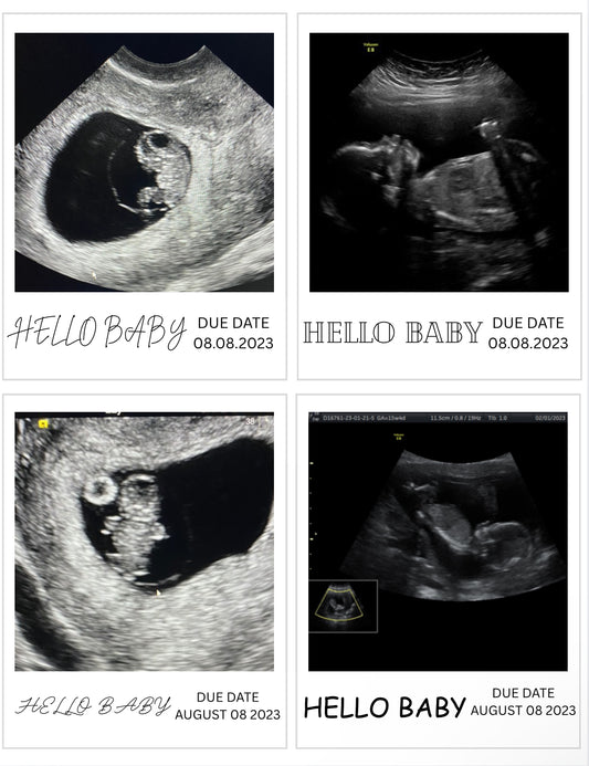 Baby Announcements Flat Magnets